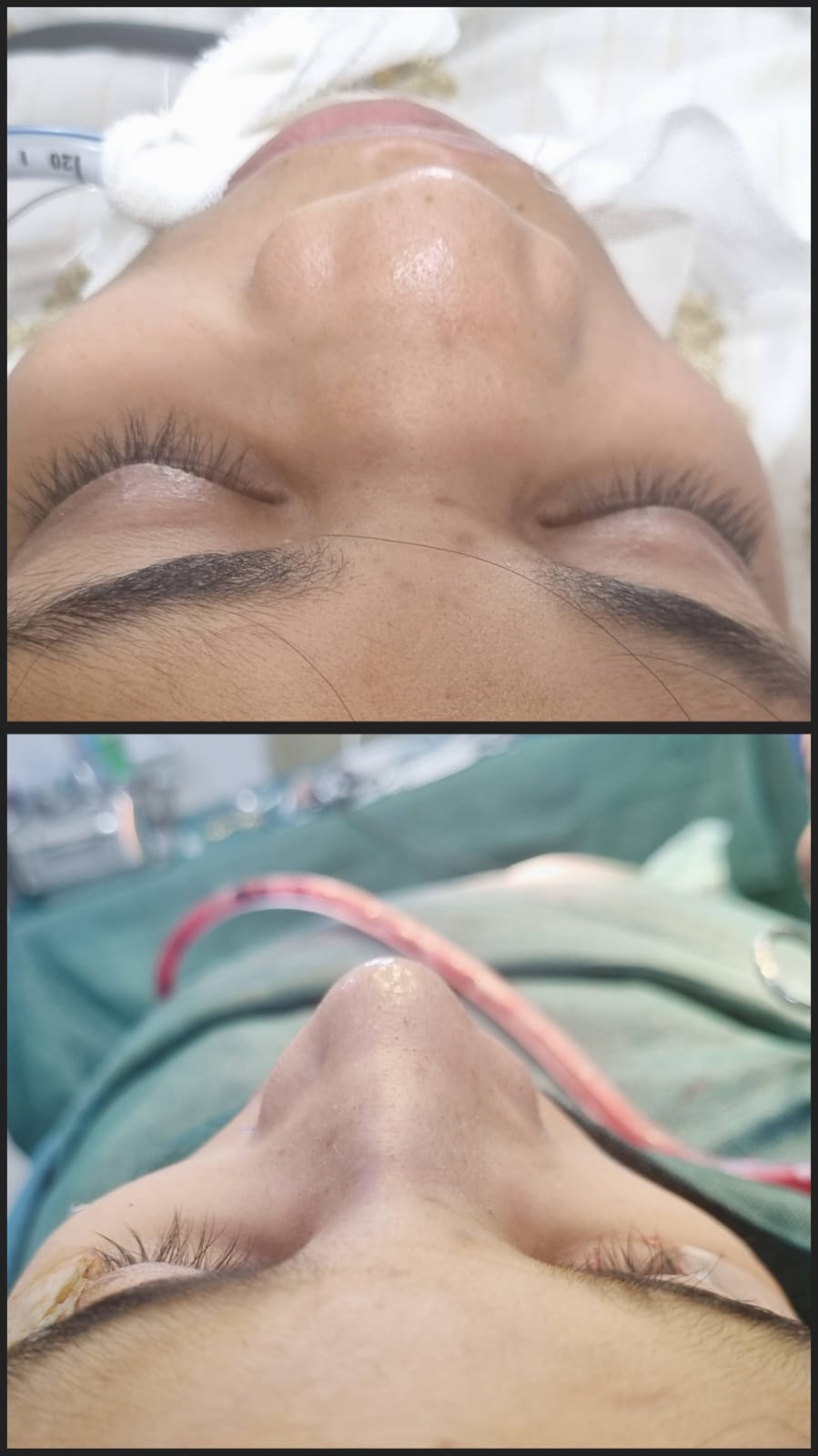Before & After 70
